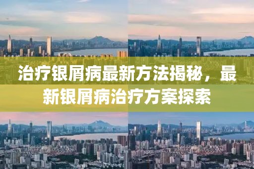 治療銀屑病最新方法揭秘，最新銀屑病治療方案探索